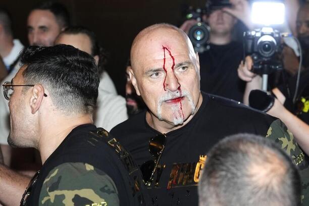 John Fury si ze šarvátky odnesl krvavé zranění