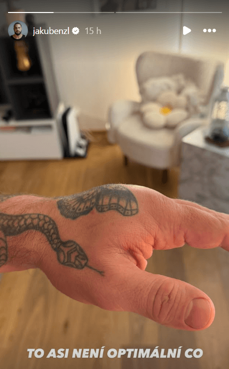 Jakub Enžl ukázal nateklou ruku